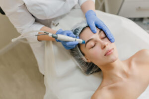 Tratamiento láser facial