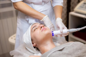 Los avances del láser facial