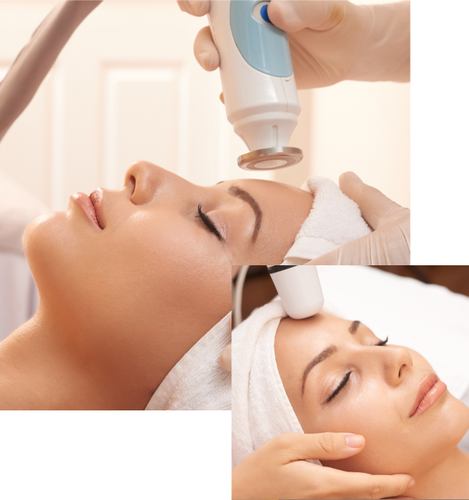 Ultherapy Lifting facial sin cirugía