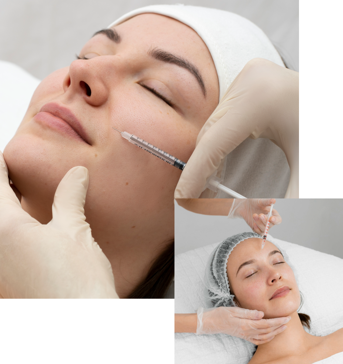 Mesoterapia facial