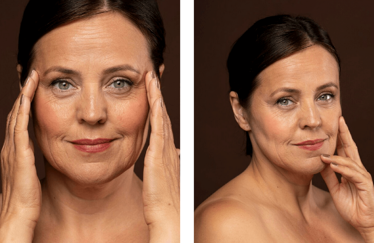 rejuvenecimiento facial