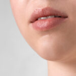 ¿Cuánto dura el ácido hialurónico en los labios?