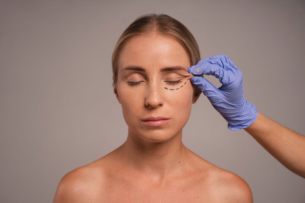 carboxiterapia para ojeras en Barcelona